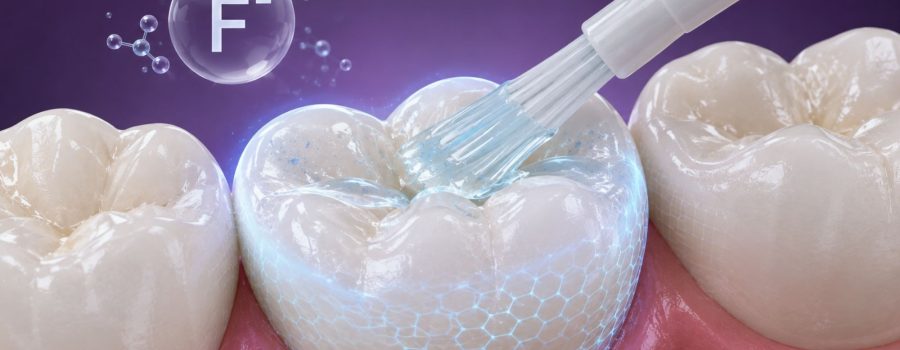 Aplicación-de-Fluor-Clínica-Dental-DUOAM-Coatepec-Veracruz