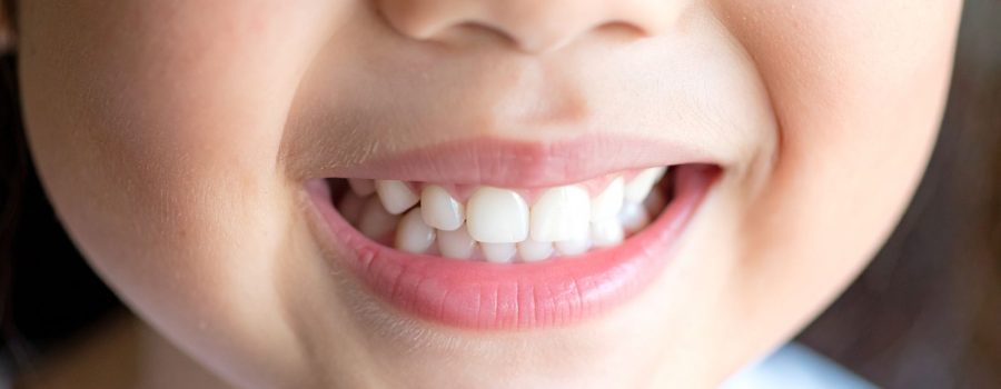 Dientes-de-leche-Odontopediatra-DUOAM-Cínica